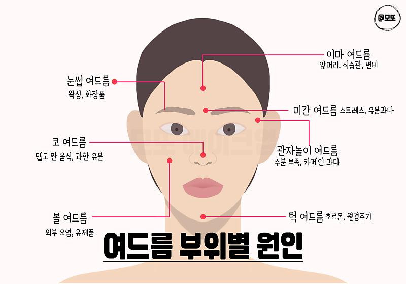 여드름 부위별 원인/ 출처 -네이버포스트[모또 뷰티]