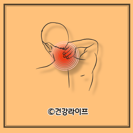 목디스크 증상 두통 예방법 치료방법