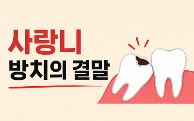 사랑니 발치의 중요성