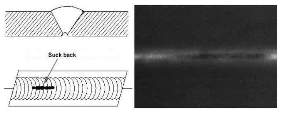 내부 오목(Internal Concavity / Suck Back)