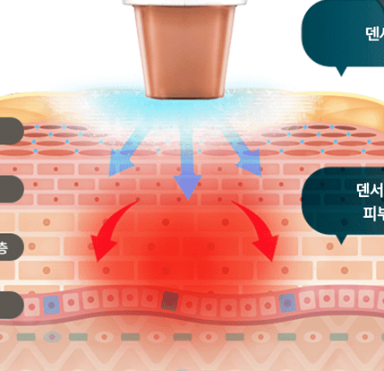 ๋ด์ํฐ ๊ณ ์ฃผํ,ํจ๊ณผ๋ถํฐ ๊ฐ๊ฒฉ๊น์ง ์๋ฒฝ ์ ๋ฆฌ!