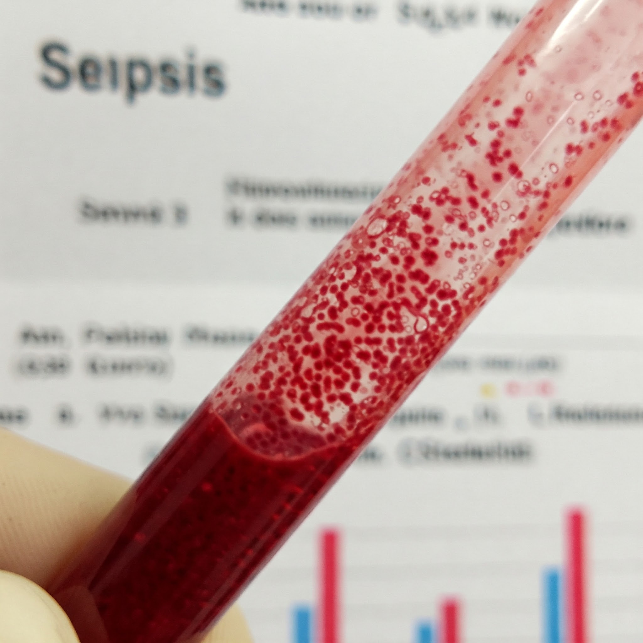 패혈증 혈액 이미지