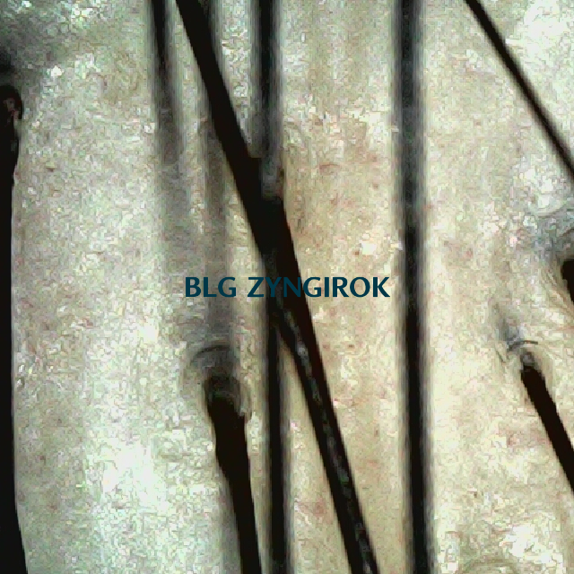 피나모아 복용 14주차 두피 사진 - 정수리 위치 모습이다.