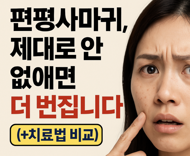 편평사마귀 방치 시 악화 경고 썸네일 이미지