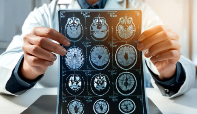 당뇨병과 치매의 연관성