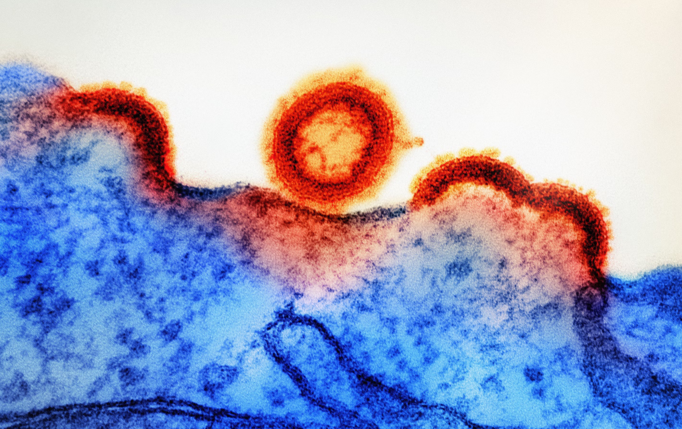 헬리코박터 전염