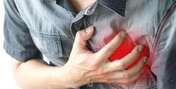 급성 심근경색과 관련된 사진