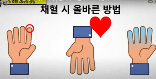 당뇨관리: 손가락마다 혈당이 다른 이유