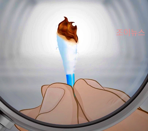 갈색 귀지_출처:유튜브더팁