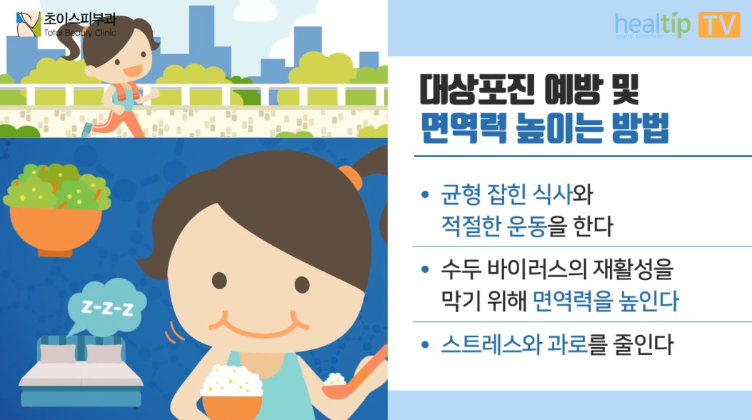 대상포진 예방 및 면역력 높이는 방법