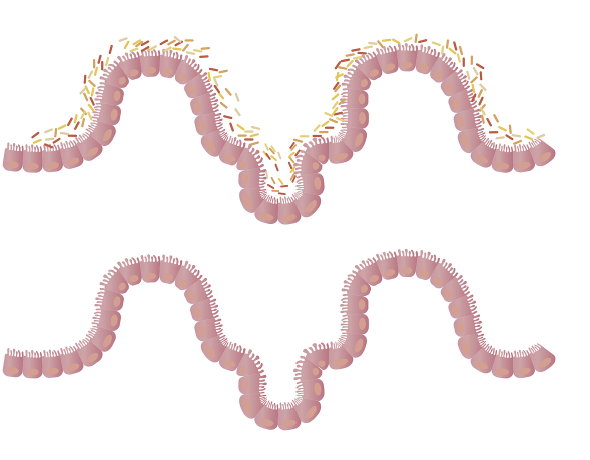 Probiotic intervention 후 metabolome 변화 분석 – Personalized Nutrition 적용