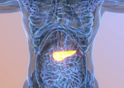 췌장암 초기증상 검사방법 생존율 알아보자!
