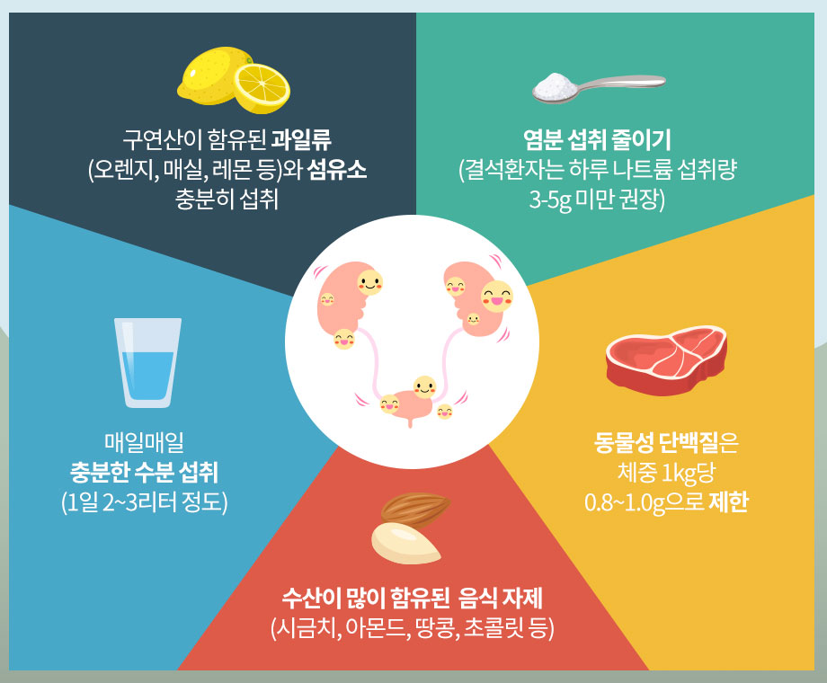 요로결석 증상, 원인, 치료방법