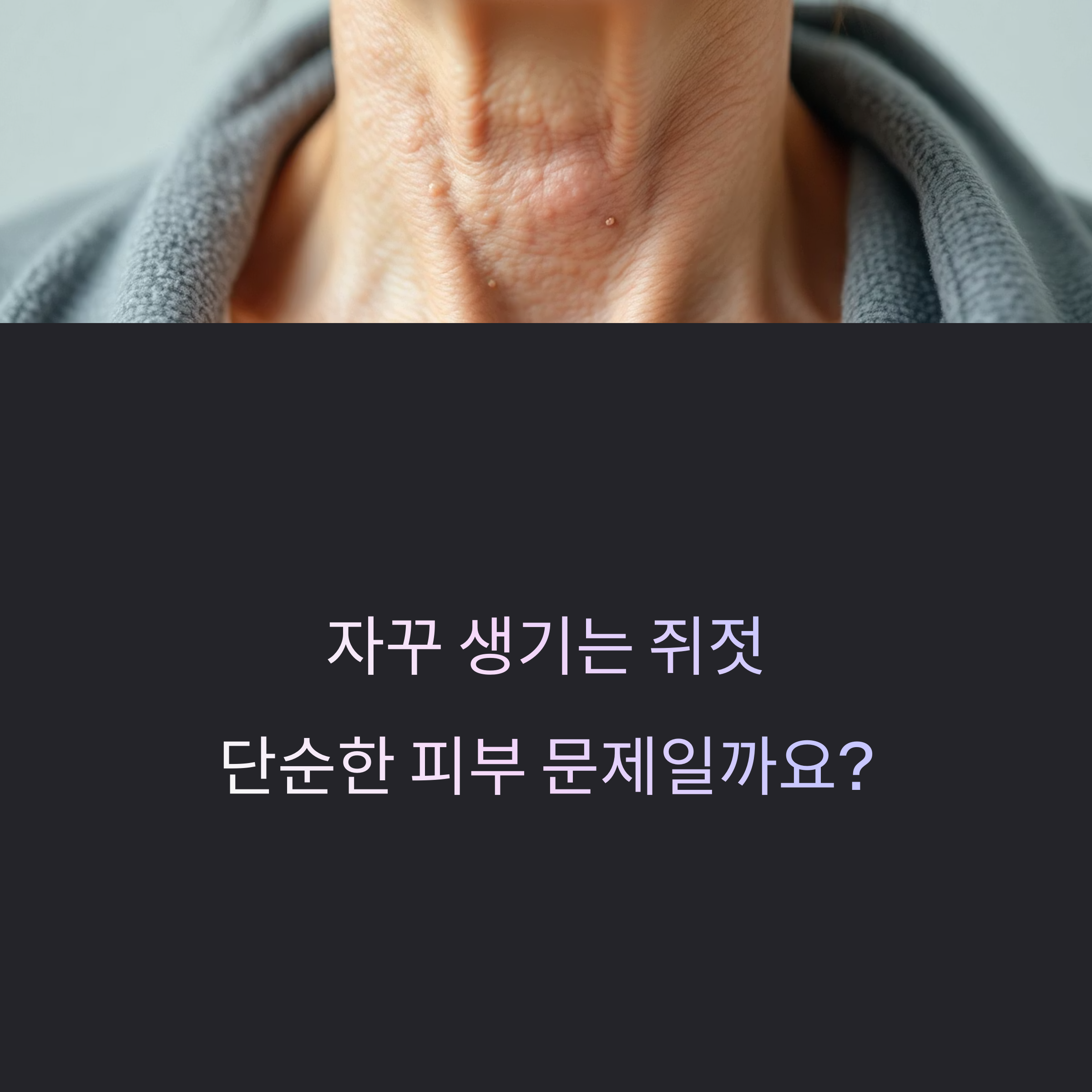 쥐젓이 왜 생길까? 원인과 발생 이유를 제대로 알아야 합니다