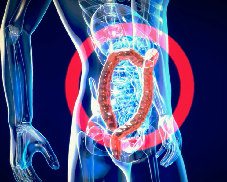 지방간 없애는 방법