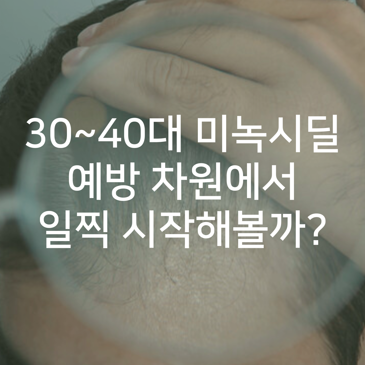 30~40대 미녹시딜 예방 차원에서 일찍 시작해볼까?