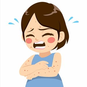 홍역 증상 완벽 가이드