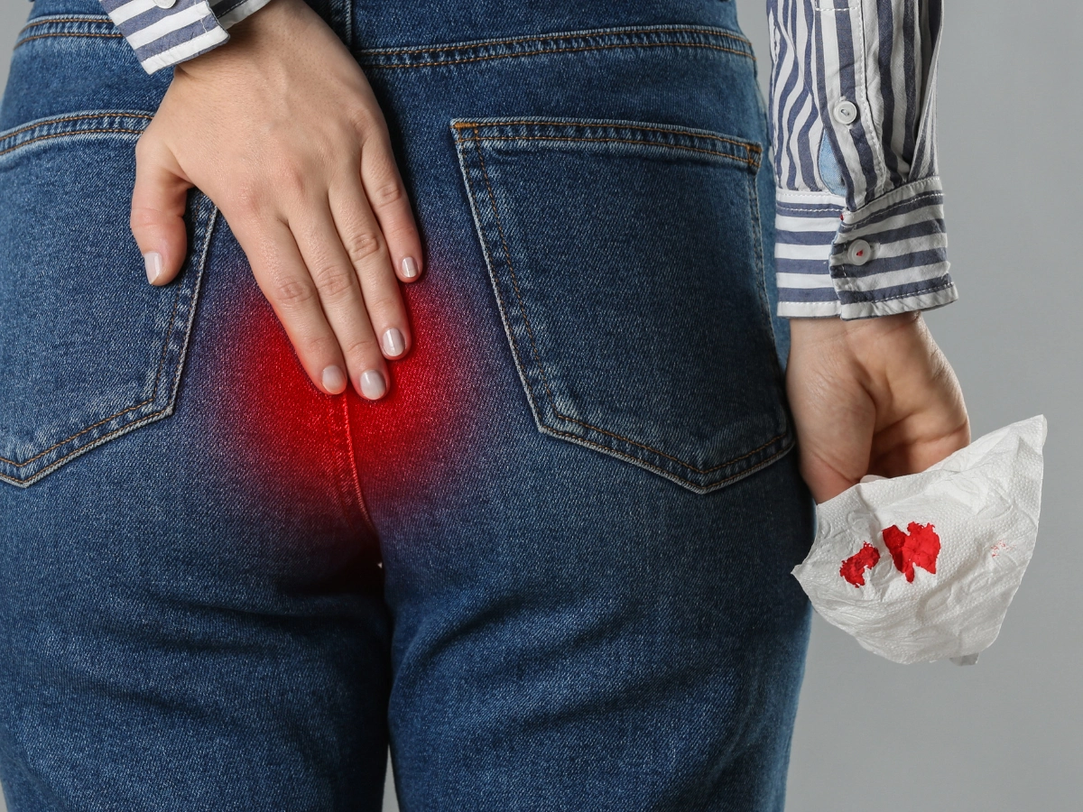 치질 때문에 출혈이 생긴 여자