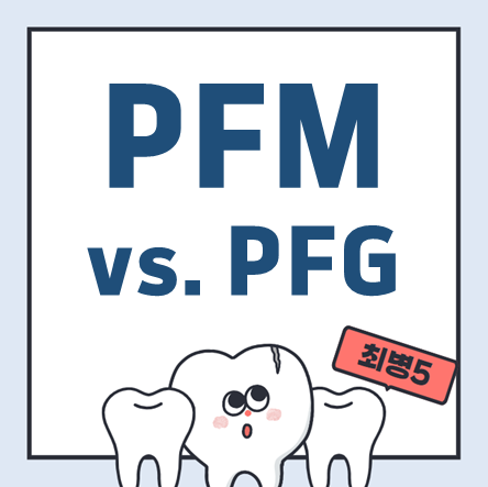 PFM과 PFG 임플란트의 차이와 장단점: 어떤 것을 선택해야 할까요?