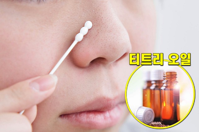 코 피지 제거법, 코 블랙헤드 없애는 방법, 티트리 오일, 팁줌