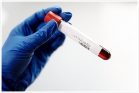 피곤하고졸린증상 피로감회복하기