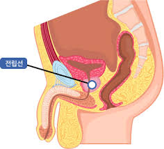 전립선염의 증상