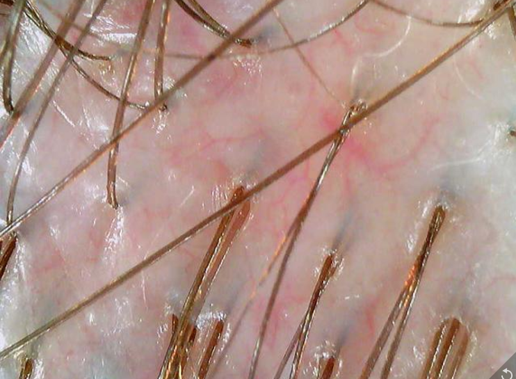 Sensitive Scalp Relief&amp;#44; Hydrated Scalp&amp;#44; Improved Circulation&amp;#44; Clear Scalp Environment&amp;#44; Cold Plasma Care After