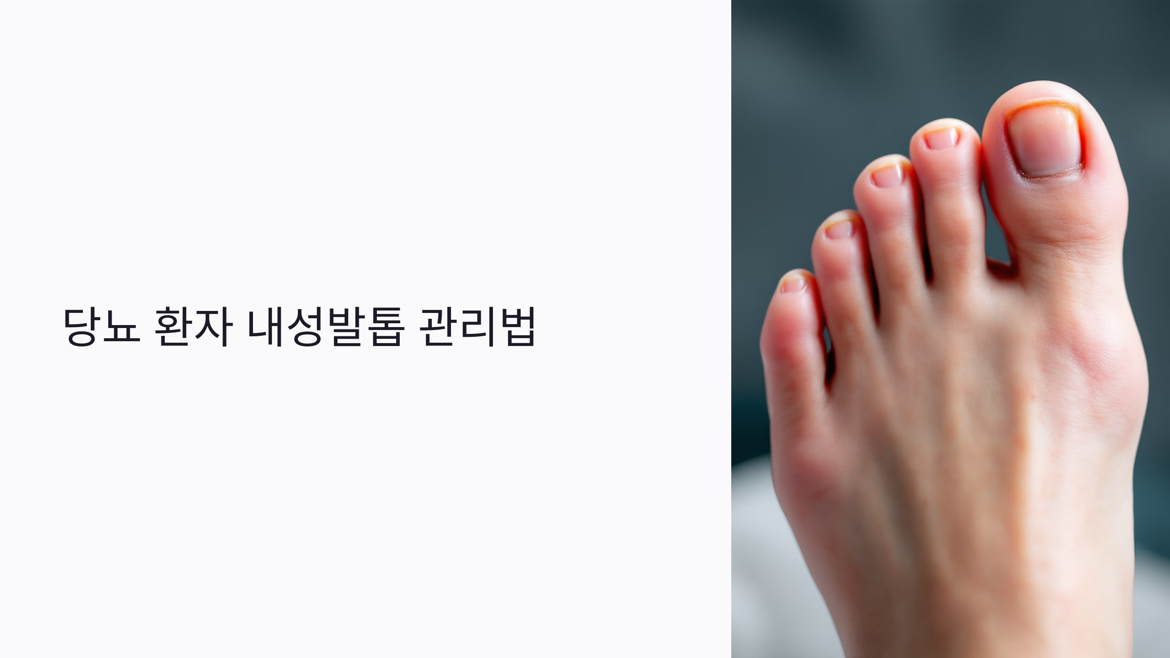 당뇨 환자 내성발톱, 방치하면 위험합니다! 감염 막는 7단계 관리법