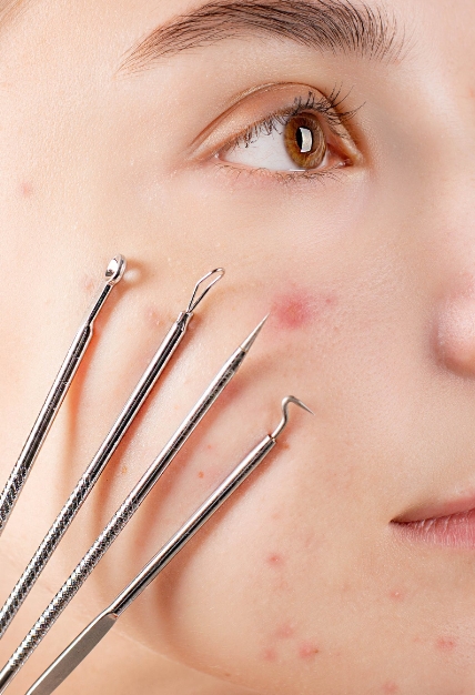 아클리프-4세대