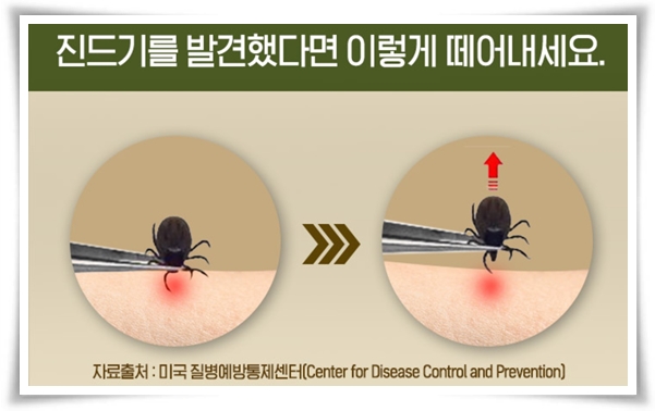"진드기" 야외 활동의 숨은 적, 안전한 야외 활동을 위한 가이드!