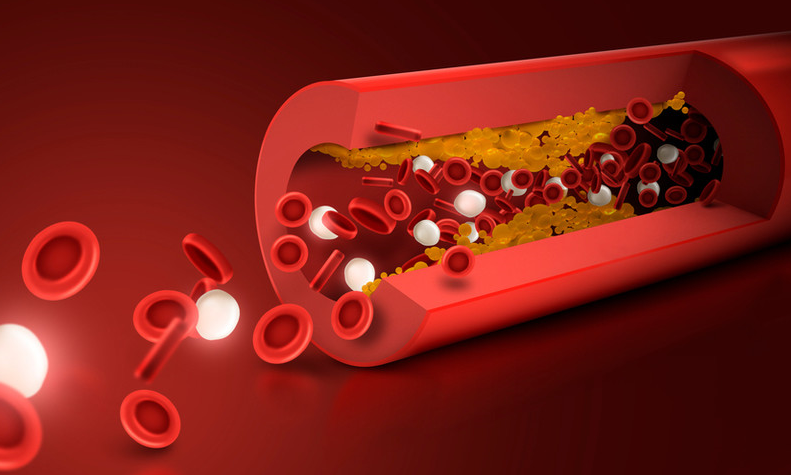 콜레스테롤 낮추는 방법