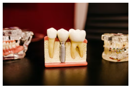 임플란트 장단점