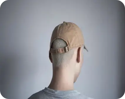혹시 나도 탈모일까? 초기에 알아채야 할 7가지 징후