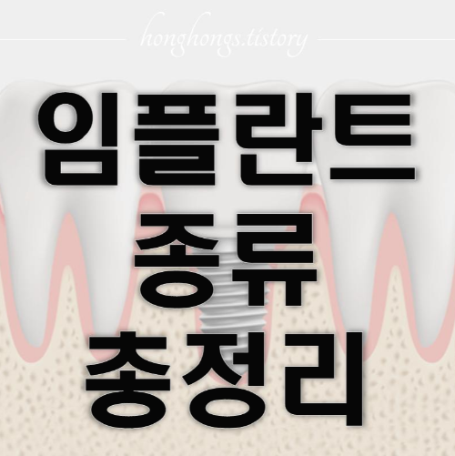 임플란트 종류