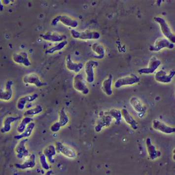 뇌 먹는 아메바 관련 사진