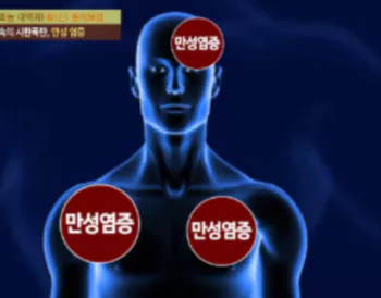 항염작용