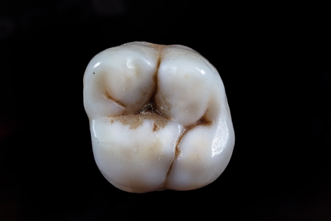 Implant