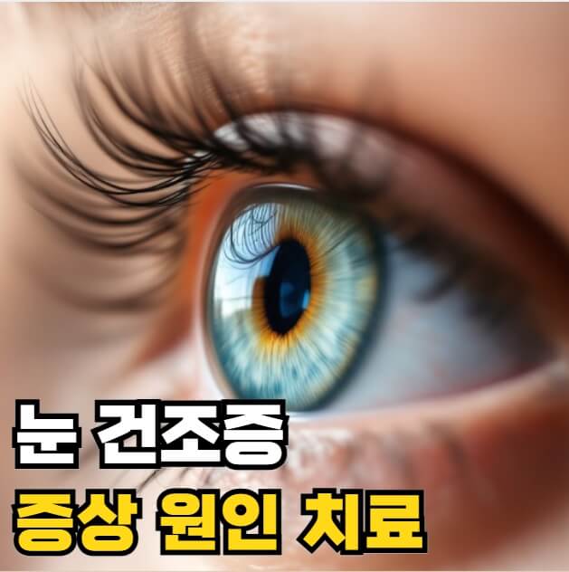 눈 건조증 증상 원인 치료