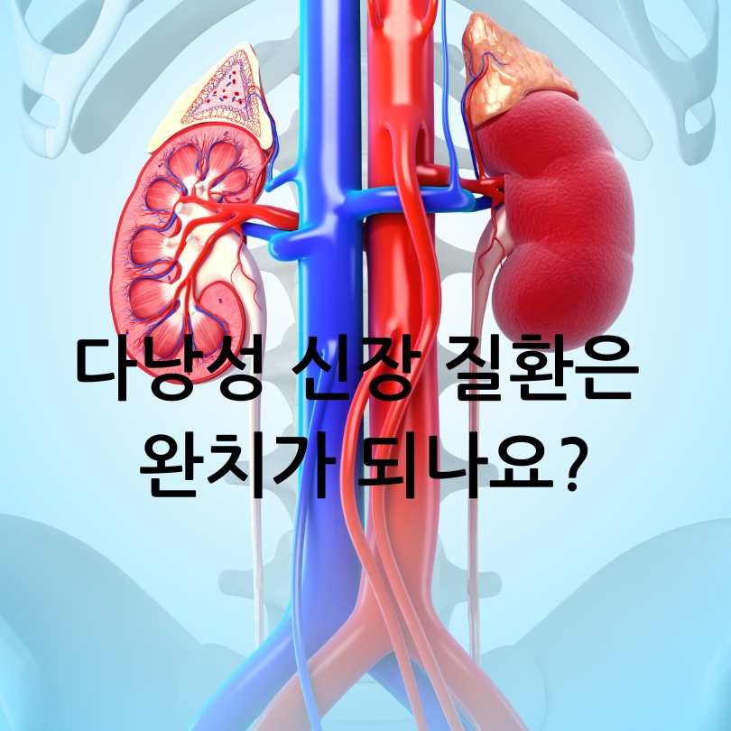다낭성 신장증후군 증상과 치료법