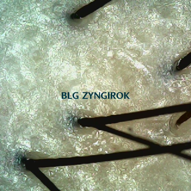 피나모아 복용 21주차 - 정수리 위치 두피 모습이다.