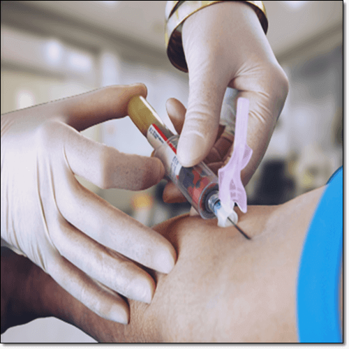 간경화 초기증상