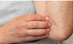 녹용 효능 부작용, 녹용 먹을 때 주의점, 녹용가격