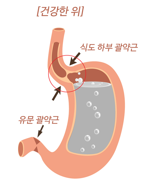 명치통증 원인 위치 역류성 식도염 급체 명치 가슴 통증 예방법