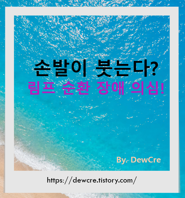 손발이 자주 붓는다면? '림프 순환 장애'를 의심해야 합니다