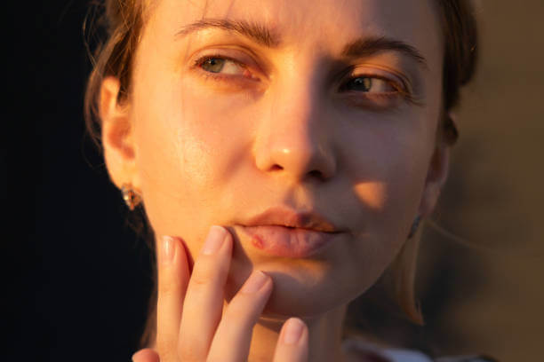 헤르페스 증상과 치료법, 완벽 가이드!