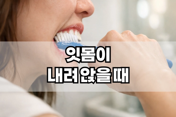 잇몸이 내려 앉을 때