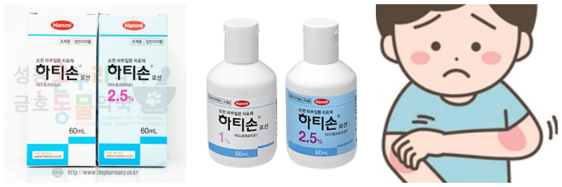 하티손로션, 피부염 사진