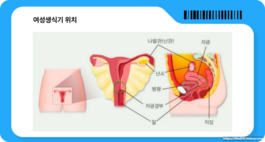여성생식기 위치