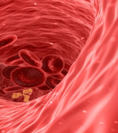 양파 효능 사진24