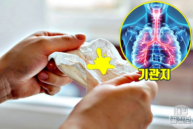가래 색깔별 증상, 진한 노란색 가래색깔 기관지염 증상,건강 팁줌 매일꿀정보